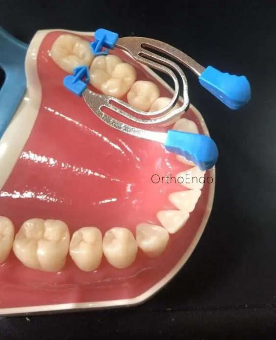 Dantų Endodontinis Matricos, kurių skerspjūvio Kontūrinis Metalo Pavasario Įrašą Žiedai Matricas Gnybtus Pleištai Stomatologas Įrankiai Tiekėjas Vertus naudoti w Atsarginių